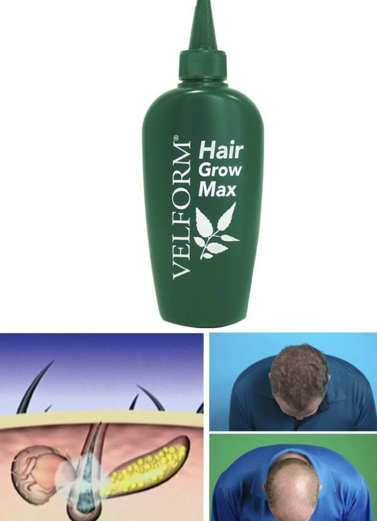 Hot BADER "VELFORM Hair Grow Max" Haarwasser