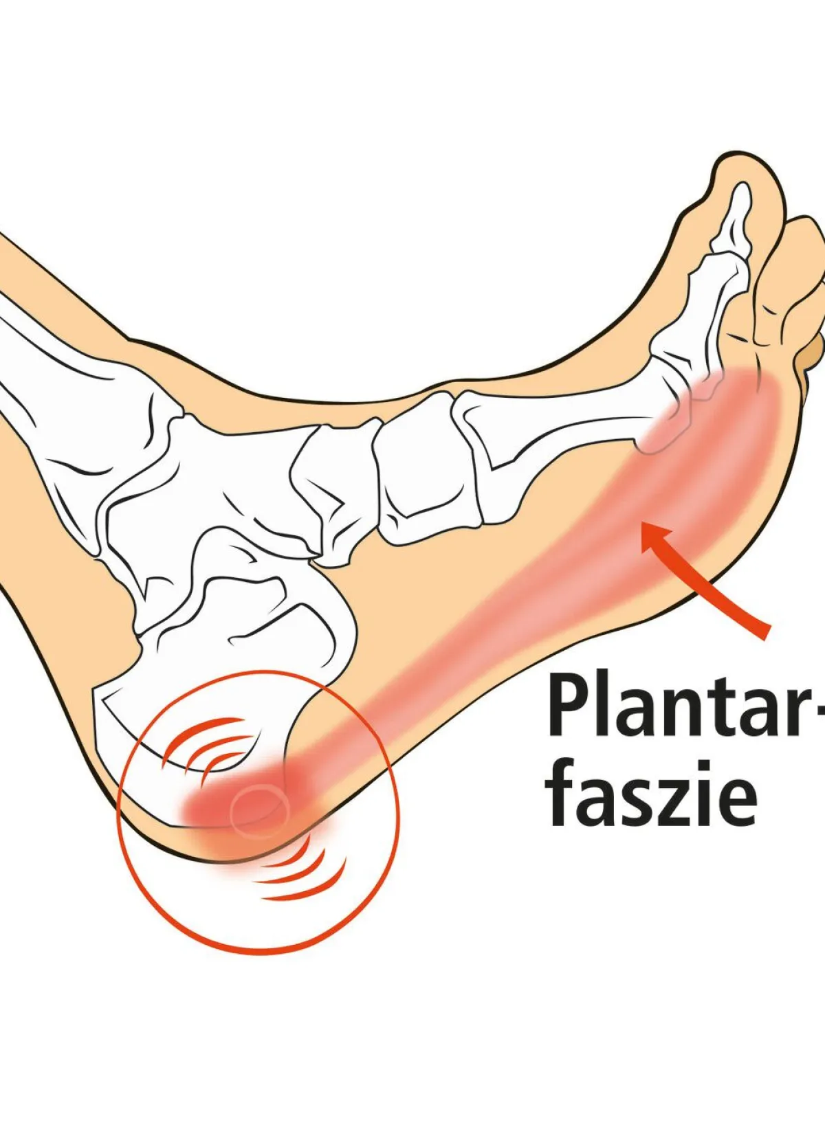 Clearance BADER Vital Comfort Faszien-Fußroller ROT